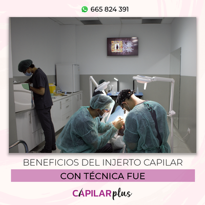 Beneficios del injerto capilar con técnica FUE