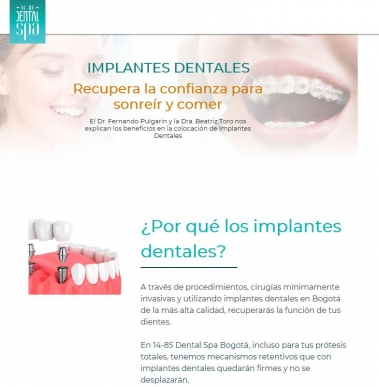 Implantes dentales - 1485 - Dental Spa